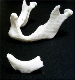 physical print of the jaw and