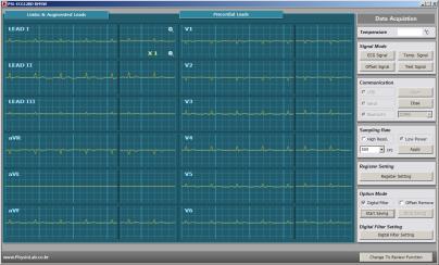 12Ch. ECG Signal