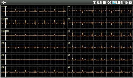 ECG Realtime Graph