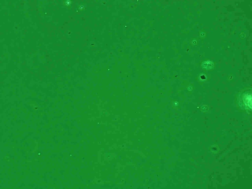 해포석시험편의 PCM 분석사진 위상차현미경동등시험기준에따라분석 구분 투과전자현미경분석결과 ( 단위 : 개