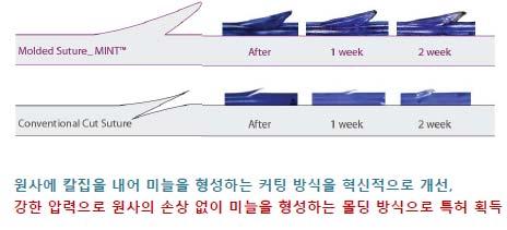 의료기기가운데인공유방보형물의부작용이가장높아안전성측면에서동사제품에대한수요확대전망 현재인공유방보형물의경우최근언론에서지속적으로관련제품들의부작용이증가하는사례를지적하고있고실제식약청사례에서도전체의료기기가운데부작용과관련된신고가유방보형물이차지하는비중이 28.9% 로가장많다는사례를보더라도제품의안정성을인정받은동사제품에대한수요는확대될것으로기대된다.