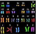 karyotyping) 특수핵형분석 (Special karyotyping) acgh SNP 어레이 (SNP array) 전장유전체분석