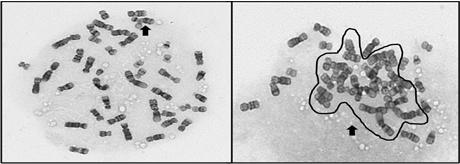 식품의약품안전평가원 2 인시투염색체분석시분석조건비교결과 [ 그림 2.] 분열중기세포의겹침정도. 좌 ) 염색체하나하나가떨어져있어구분이쉬움 우 ) 염색체가모여있어서로서로가구분이힘듦.
