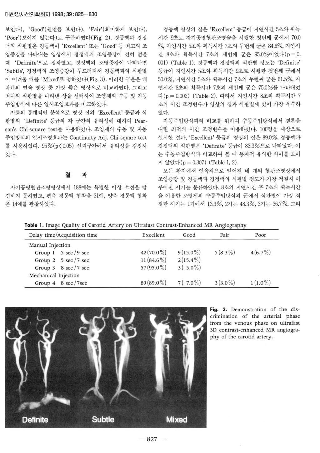 애ι대한밤사선의학호 지 1998; 39: 825-830 보인다 ), Good ( 웬만큼보인다 ), Fair ( 희미하게보인다 ), Poor ( 보이지않는다 ) 로구분하였다 (Fig. 2).