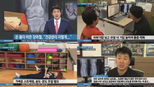 Hunter, Kwang Am Jung. Is end-stage lateral osteoarthritic knee always valgus?