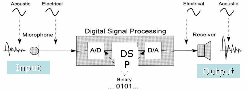 노인의청각재활 2) 디지털보청기 - 소리의왜곡이적다 - 소음환경에서어음판별력증가 - 소리의되울림감소 3) 보청기선택의선정요소 1 구조적인문제의고려 : 귀의모양,