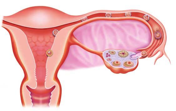 (3) 수정과임신새로운생명은정자와난자의만남으로부터시작된다. 여성의질속으로들어온정자가자궁을지나나팔관의끝부분까지헤엄쳐가서난자와만나수정란이되는것을수정이라고한다.
