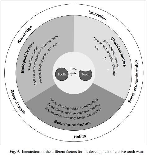 76 특수건강진단의현행화및실무지침의개정 별첨 2. 치아부식증의이해 치아부식증은다양한원인에의해발생한다. 직업적인산노출은치아부식증의위험을증가시키는원인중하나다. 그러나다른화학적요인, 생물학적요인, 생활습관 ( 식이, 약물, 칫솔질습관등 ) 이영향을준다.