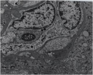 eosin stain, 200). (B) No definite immune deposition was observed by electron microscopy.
