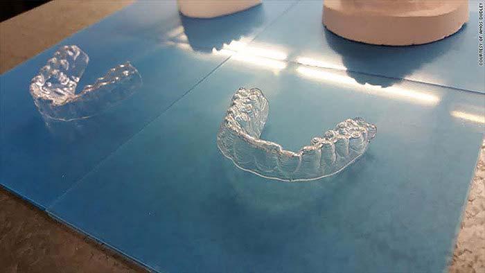 3D 프린팅으로만든치아교정기 자료 :