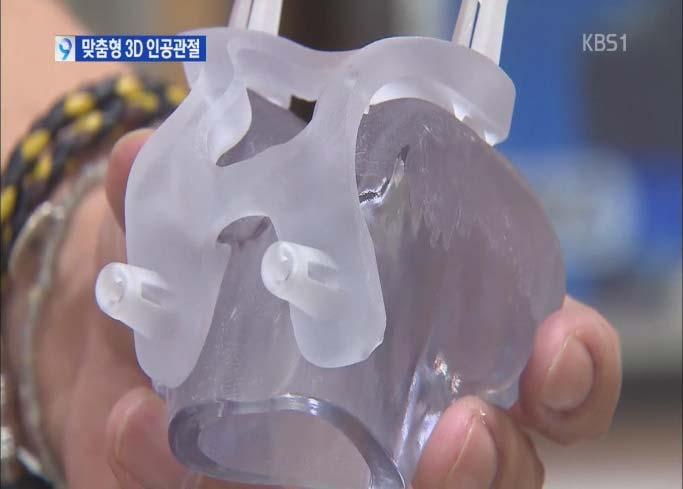 3D 프린팅으로만든인공콧구멍과기도 그림 182.