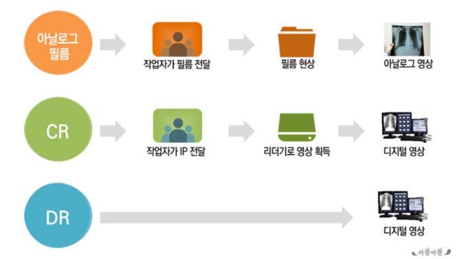 엑스선진단기기는엑스선검출방식에따라아날로그, 디지털방식으로구분한다. 각각엑스선을필름, 디지털검출기를통해검출한다. 디지털방식은 CR방식과 DR 방식으로나뉜다. CR방식은필름이아니라반복사용이가능한 Image Plate( 카세트라고도함 ) 를리더기로읽어영상을얻는다. DR 방식은 Flat Panel 를이용하여곧바로컴퓨터에저장된다. CR과달리별도의리더기가필요없다.