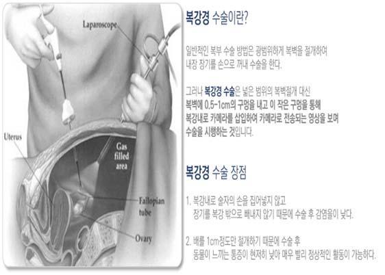 외과로봇수술은의사가외부의로봇조종석에앉아 4개의로봇팔을이용하는첨단수술이다. 환자입장에서는개복수술보다흉터가적고, 빨리회복할수있다는장점이있다. 또한출혈량이낮고, 합병증이발생할확률이적다.