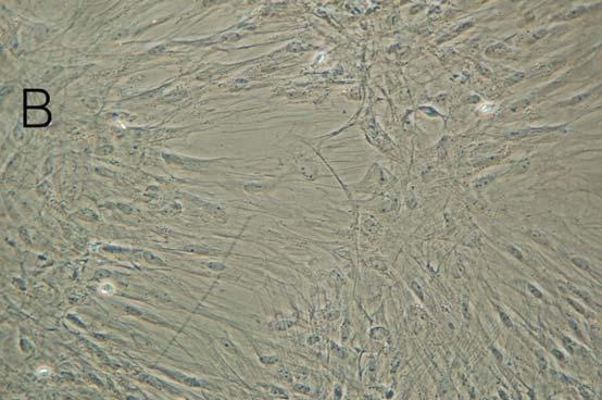 O staining( 100) (C) Adipocyte progressed differentiation( 100) (D) Adipocyte dyed oil red O staining( 100) 2)