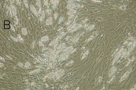 preadipocyte differentiation.