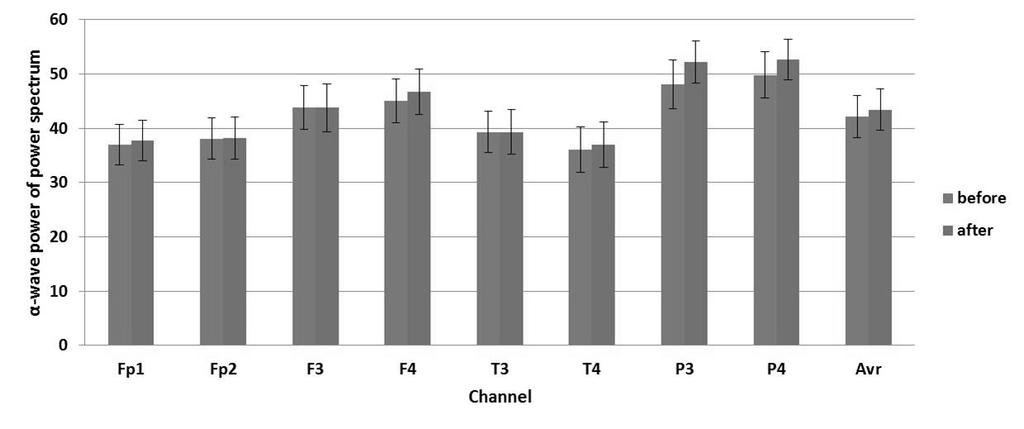 08 의감소를보였으나통계적유의성은없었다 (Fig. 4). 3. β 파의변화 실험군에서의시술후베타파의변화는전채널에서고른상승을보였으며특히 T4 와 P3, P4 에서는유의한상승을확인할수있었다. 8 채널평균값의비교에서 16.38 에서 18.47 로 2.10 정도의유의한상승이관찰되었다 (Fig. 5).