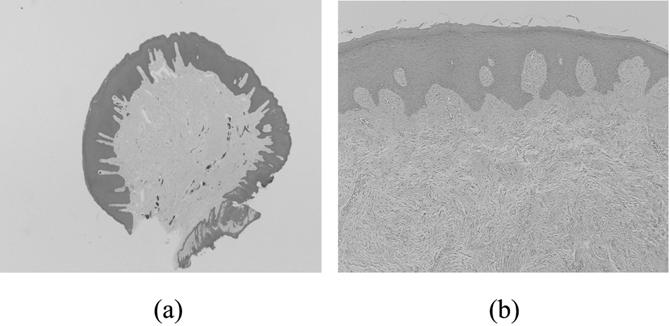 Journal of Dental Hygiene Science Vol 5, No 3, pp 97~103 (2005) TGF-β1 EGFR e v, w w ù w z sƒw sƒ ³ s w š, d w ƒ ordinal scale» ww, TGF-β1 EGFR x» w Mann-Whitney U test w w TGF-β1 EGFR v w