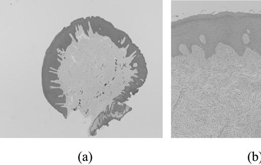 w w sd Ì ƒù ƒ ƒ ƒyd Ì ƒ 'JH (a), (b) Irritation fibroma(a : H/E, 10, b : H/E, 200) 'JH Oral leukoplakia 'JH B Normal oral mucosa - Positive staining in the all layers except keratinized layer