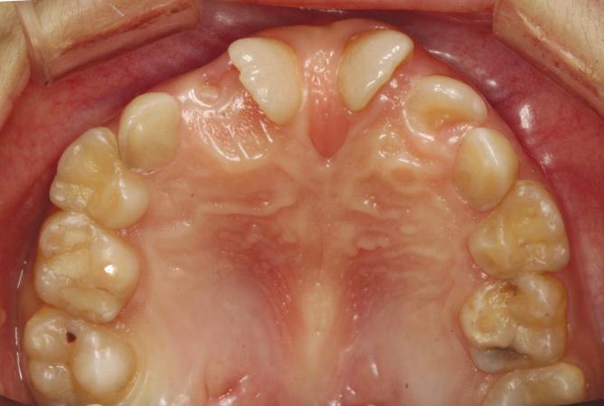 J Korean Acad Pediatr Dent 38