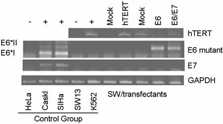 TRAPeze Detection Kit) 의동위원소 end-labeling은 10 mci/ml g- 32 P-ATP, TS primer, 10X kinase buffer, T4 polynucleotide kinase 를 37 에서 20분동안반응시킨후 85 에서 5분간효소를불활성화시켜사용하였다.