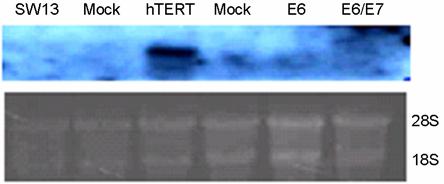 먼저 telomerase subunit인 pcdna3-htert 유전자와 ptarget-e6mutants, ptarget-e6/e7 유전자의벡터를이용하여 telomerase negative 세포, SW-13에 liposome을이용한 transfection을하였다.