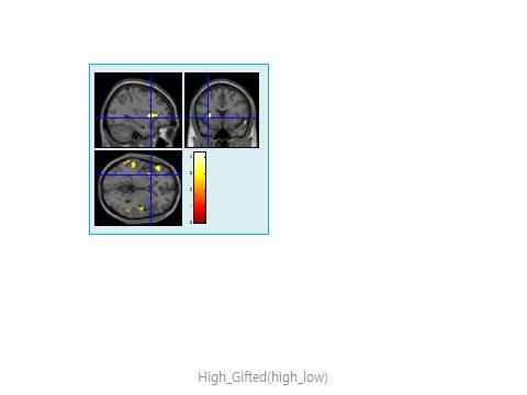 [ 그림 19] 상위그룹의 fmri 과제 ( 복잡과제 ) 수행시활성화된뇌영역
