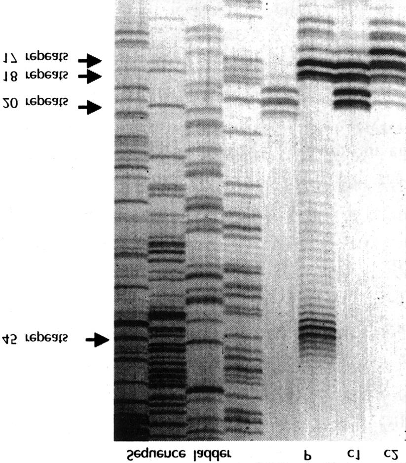 Fig. 1. PAGE analysis of CAG repeats in HD gene loucs. Results with CAG-CCG method.