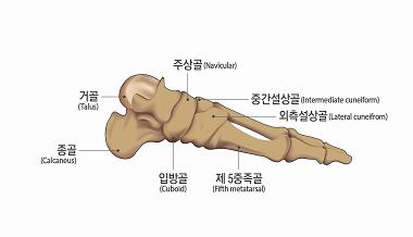 등이제거된후에장해를평가한다. 단, 제거가불가능한경우에는고정물등이있는상태에서장해를평가한다.