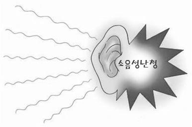 [ 붙임 5.6] 소음성난청예방수칙 OPS 소음성난청예방수칙 소음성난청이란? 소음성난청은한번생기면치료방법이없습니다!