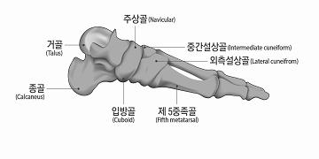 이하가된경우를말하며, 다른네발가락에있어서는중족지관절의신전운동범위만을평가하여정상운동범위의 1/2 이하로제한된경우를말한다.