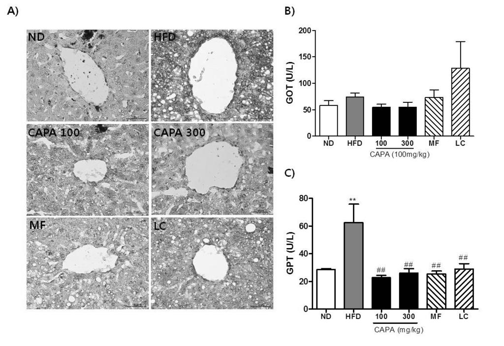 Fig. 3. Effects of CAPA extract on lipid accumulations in livers. (A) Oil red O stained liver tissues ( 200), (B) glutamic oxaloacetic transaminase (GOT), (C) glutamate pyruvate transaminase (GPT).