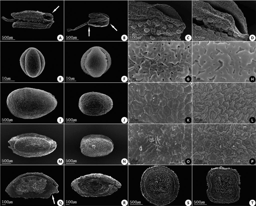 한국산 작살나무와 좀작살나무(마편초과)의 분류학적 형질 재검토 145 Fig. 2. SEM micrographs of selected reproductive and vegetative characters in Callicarpa japonica and C. dichotoma. C. japonica (A, C, E, G, I, K, M, O, Q, S), C.