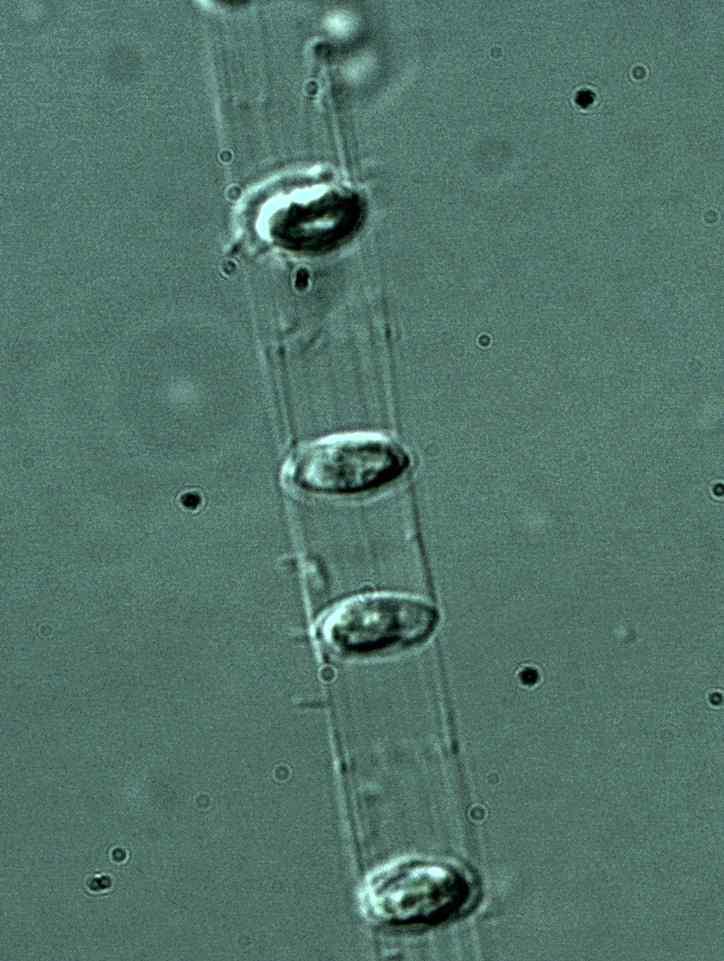 < 부록 12> 향호의식물플랑크톤우점종사진 1. 현미경사진은고정시료와비고정시료로나누어서촬영하고분류학적특성이반드시포함하여야함 2.
