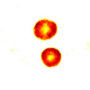 x -axis rotation y-axis translation 3 μm y-axis translation 4 μm 5 μm y 최근 본 연구진은 시편의 3차원 형상을 실시간으로 측정하 z-axis rotation y-axis rotation 고 이를 바탕으로 포획광의 파면을 제어하면 복잡한 형상의 시편의 방향 및 모양의 안정적 조절이 가능하다는 연구를