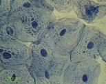 (2) 양파세포나구강상피세포를메틸렌블루로염색했을때와아세트카민으로염색했을때차이가있었는가? 있었다면어떤차이였는지설명하시오. < 그림 Ⅰ- 13> 구강상피세포 ( 1000) (3) 현미경으로관찰한결과를점묘화로그리는까닭은무엇때문일까? (4) 양파비늘잎의안쪽표피세포를관찰하는까닭은무엇때문일까?