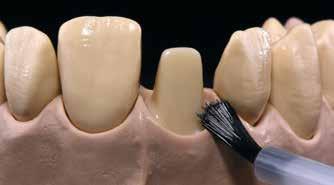 1 차 Dentin/Incisal 소성 Dentin/Incisal 재료를축성하기전모델을격리시킵니다.