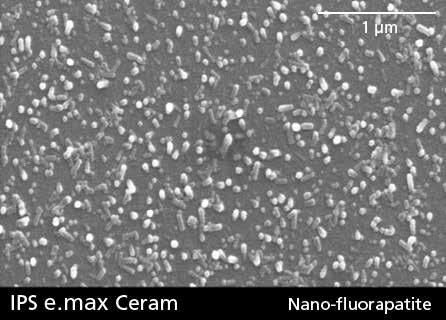 광학적성질은 100-300nm 크기의나노-형광인회석결정과 1-2μm 길이의마이크로형광인회석결정으로조절됩니다. 각각의 IPS e.max Ceram 재료는다양한농도의인회석결정을함유하고, 축성재료의종류에따라반투명도와명도, 유백광의특별하고조정가능한조합을가능하게합니다.