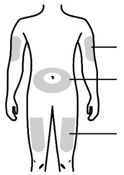 폐기용기. D 주사부위준비. 상완 복부 허벅지 다음과같은부위에주사할수있다 : 허벅지. 배꼽주변 5 cm 를제외한복부.