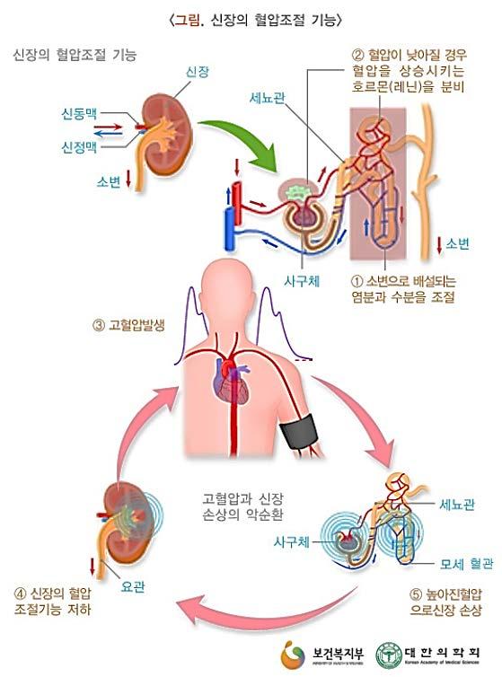 2. 신장과고혈압의관계 고혈압의발생과신장기능간에는밀접한관계가있다. 신장의기능이나빠지면고혈압을 초래하게되고, 고혈압이계속되면신장기능을더욱악화시키는악순환이발생할수있다. <Figure 2. 신장의혈압조절기능 > http://health.korea.com/healthpedia/healthpedia01.aspx?mode=view&srno=2410&page=7 3.