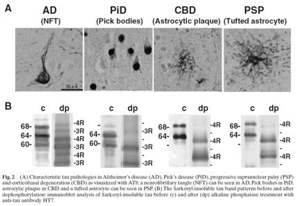 tauopathies have different isoform ratio FTDP-17: affect splicing of exon 10 4R Pick disease: 3R AD: 3R/4R