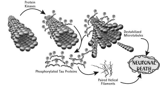 양동원 Tau hyper-phosphorylation Dynamic Equilibrium of Tau Binding Aβ Oxidative stress Inflammation Phenotypical spectrum of tauopathies with pakinsonism Predominant tau