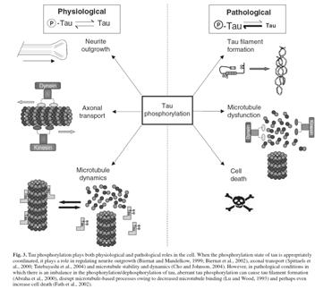 Probable(clinically definite) Gradual progressive Age onset > 40yrs Vertical supranuclear palsy and prominent postural instability with falls in first year of disease