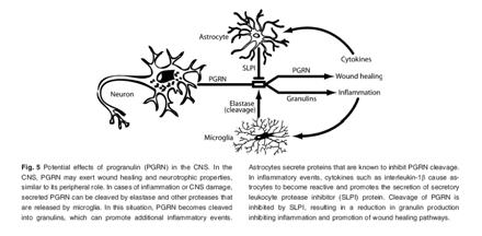 양동원 Progranulin Role of Progranulin In 2006, discovery of mutation of progranulin in FTDP-17 with no MAPT mutation.