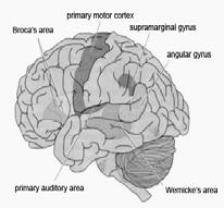 Basic Neuropsychology for the Evaluation of Dementia November 27, 2009 Gerstmann Syndrome (1930) 1. Agraphia ( 실서증 ) 2. Acalculia ( 실산증 ) 3. Right-left disorientation ( 좌우지남력장애 ) 4.