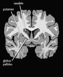 Gerstmann Syndrome & Apraxia Frontal operculum - 하부전두엽부위 ( 브로카영역 ) -