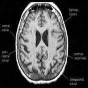 빨대로빠는흉내 4. 윙크 ( 한쪽눈만감기 ) 5. 촛불끄는흉내 Intransitive Items 1. 눈감기 2. 입벌리기 3.