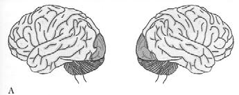 depth perception, are normal or only mildly disordered but recognition