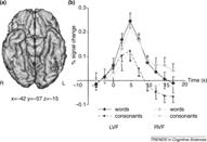 face alone, irrespective of preservation or loss of the ability to discriminate between unfamiliar faces Prosopagnosia McCarthy et al. (1997) J. Cogn, Neurosci Fusiform Face Area (FFA; Rt. > Lt.