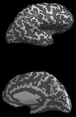 LIP saccades Human (fmri studies) Separate regions of the dorsal stream are involved in the