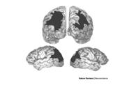 grasping AIP grasping (saccades) (grasping) Cohen & Anderson (2002) Nature Reviews Connolly et al.